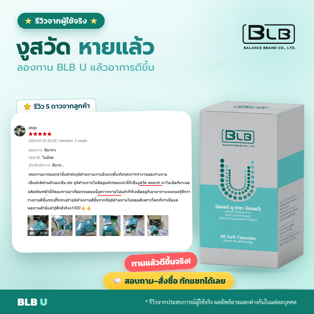 รีวิวจริง BLB U ผู้ใช้ที่เคยเป็นงูสวัด