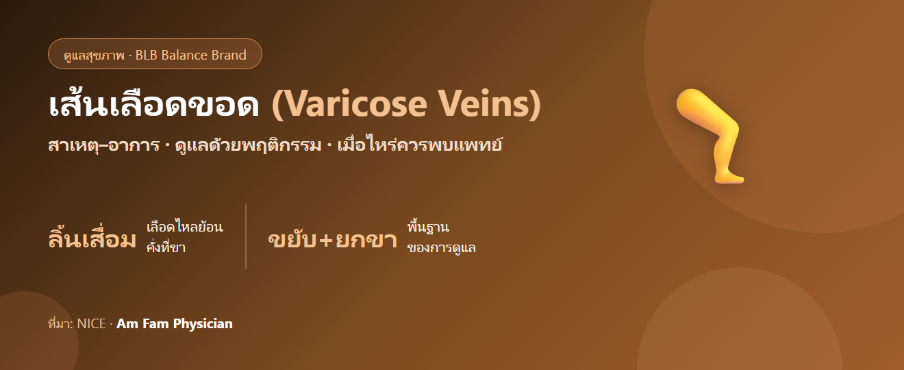 เส้นเลือดขอด (Varicose Veins) : สาเหตุ อาการ และการดูแลตามหลักฐาน