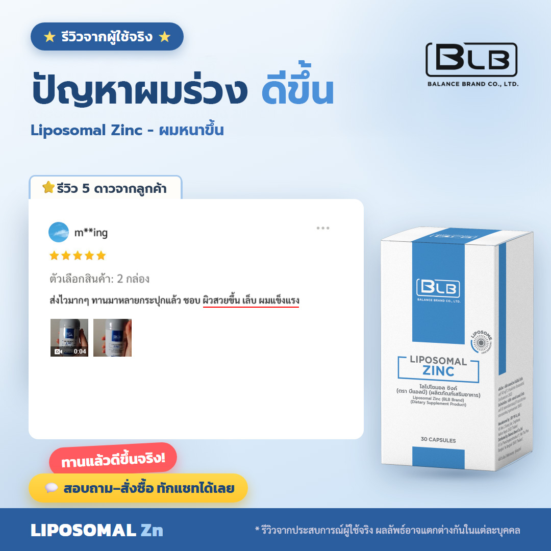 รีวิวจริง zn-rv