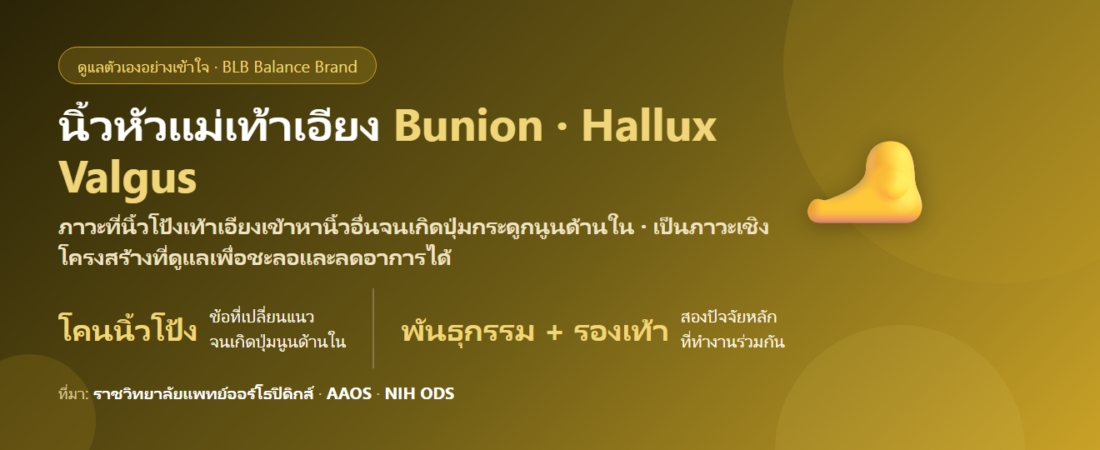 นิ้วหัวแม่เท้าเอียง ปุ่มกระดูกนูน (Bunion) ดูแลยังไง? สาเหตุ วิธีชะลอ และเมื่อไรต้องพบแพทย์