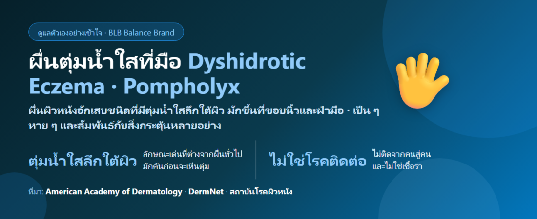 ผื่นตุ่มน้ำใสที่ฝ่ามือและนิ้ว (Dyshidrotic Eczema) ดูแลตัวเองอย่างไร และเมื่อไรต้องพบแพทย์