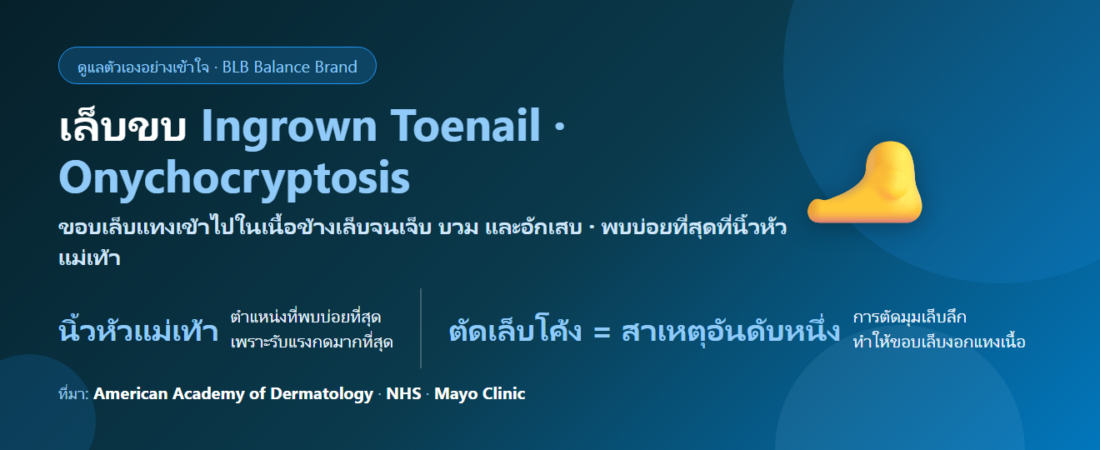 เล็บขบ (Ingrown Toenail) ดูแลตัวเองยังไง? สาเหตุ วิธีตัดเล็บที่ถูก และสัญญาณที่ต้องพบแพทย์