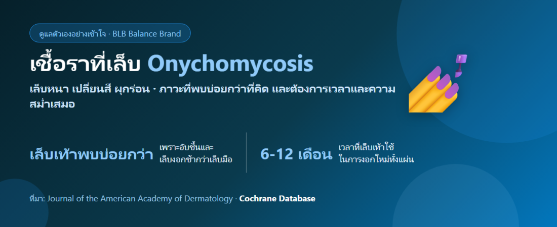 เชื้อราที่เล็บ (Onychomycosis) เล็บหนา เหลือง ผุกร่อน ดูแลตัวเองยังไง? รู้จักและป้องกันการกลับเป็นซ้ำ