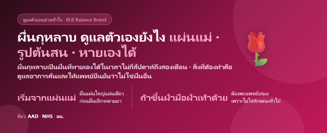 ผื่นกุหลาบ (Pityriasis Rosea) ดูแลตัวเองยังไง? แผ่นแม่ ผื่นรูปต้นสน และสัญญาณที่ต้องพบแพทย์
