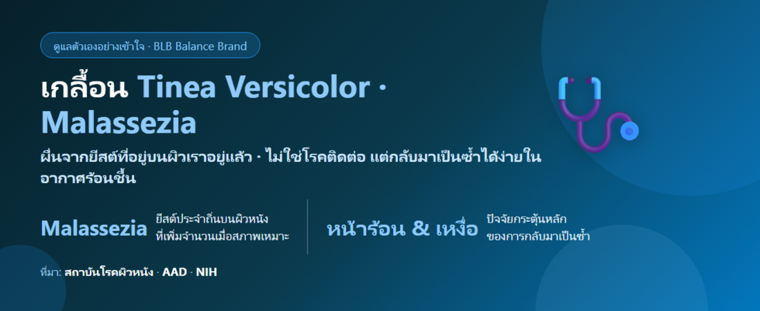 เกลื้อน (Tinea Versicolor) ดูแลยังไง? ผื่นด่างขาวด่างน้ำตาลที่กลับมาเป็นซ้ำทุกหน้าร้อน